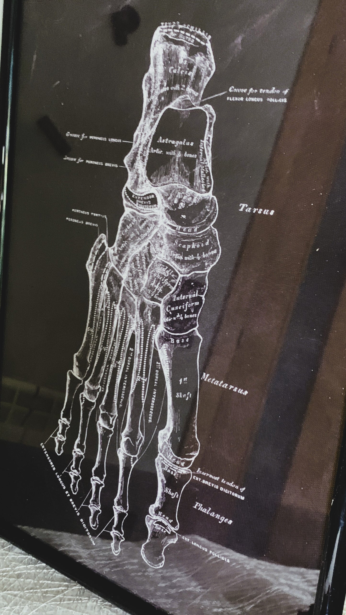 Cuadro Anatómico Vintage – Estructura Ósea del Pie Humano 1:1 | Limited Edition Anatomical Foot Bone Art