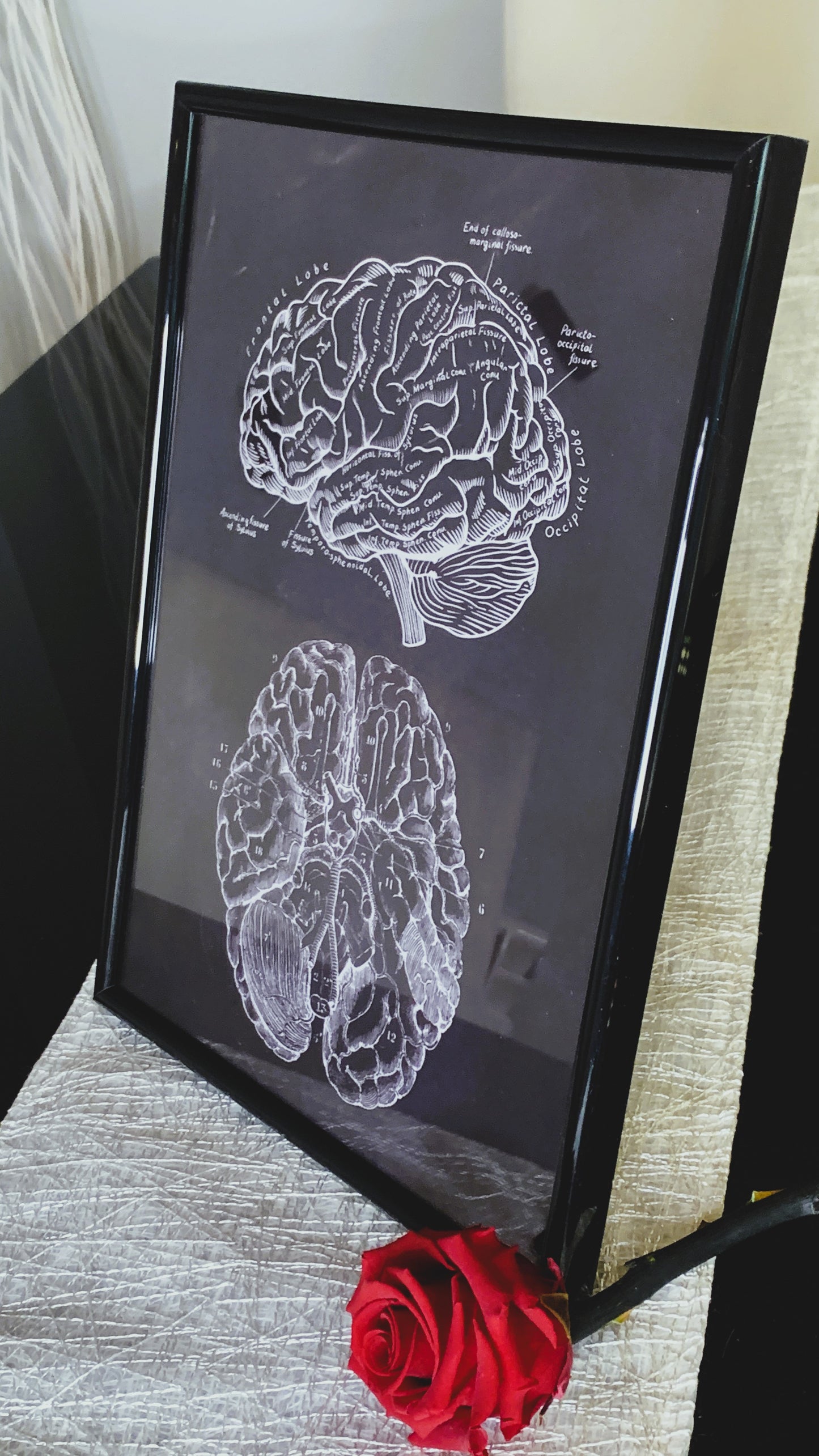 Póster Vintage de Anatomía Cerebral con Marco – Arte Médico Elegante para Doctores, Enfermeras & Estudiantes | Regalo Único de Neurociencia