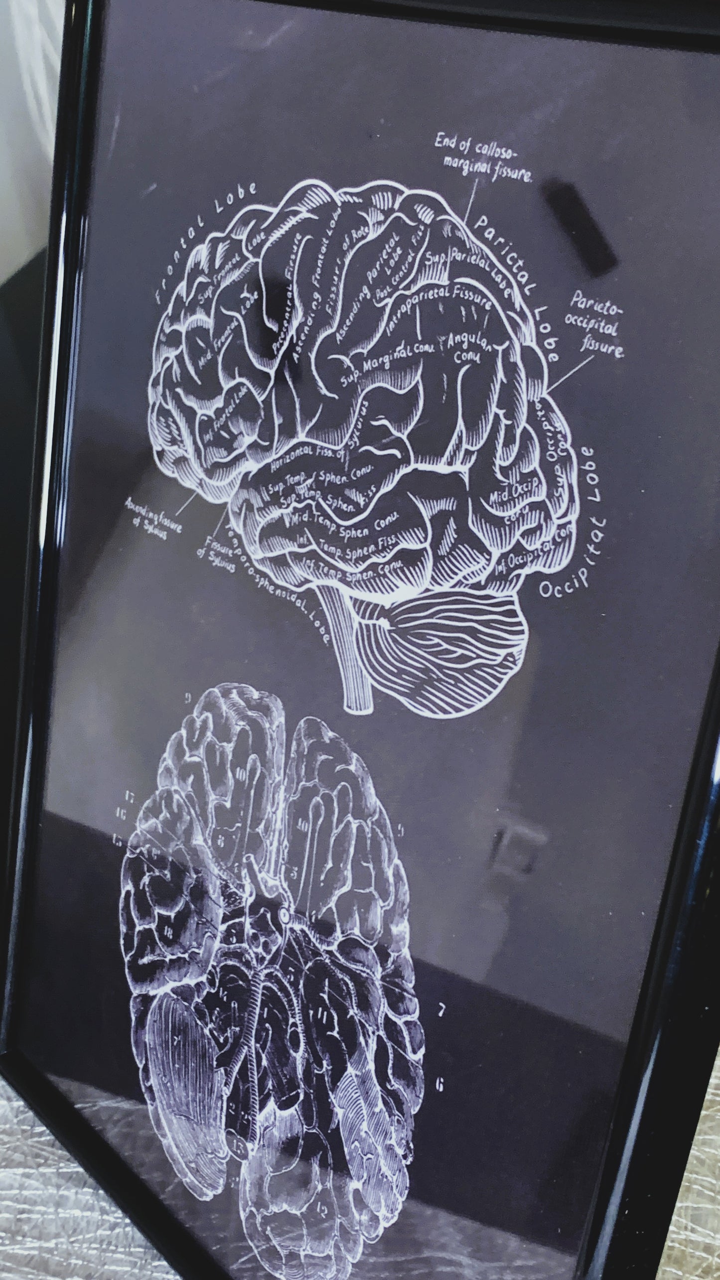 Bundle de Anatomía Cerebral – 3 Pins Esmaltados + Póster en Marco 21x30 cm + Llavero | Regalo Anatómico Gótico para Estudiantes de Medicina & Psicología